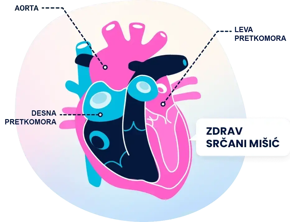 Heart illustration showing normal heart