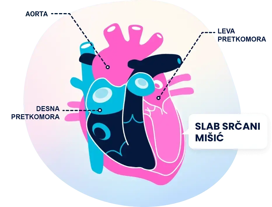 Heart illustration showing heart failure results